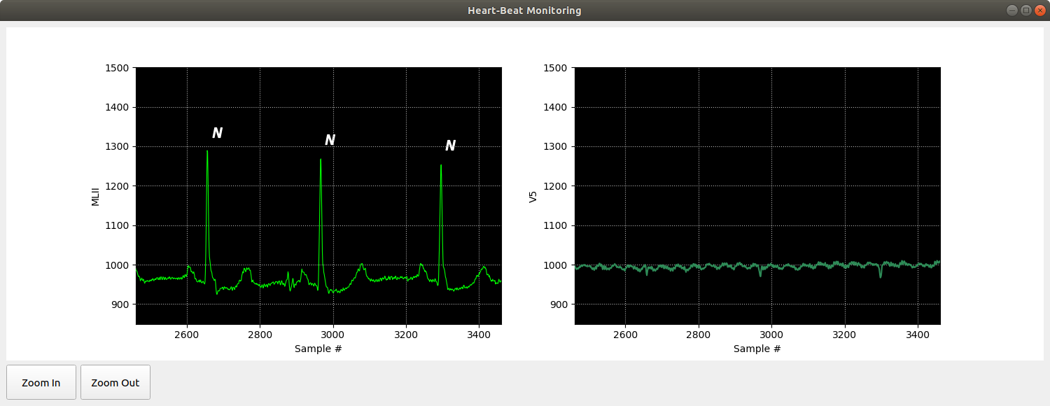 Heartbeat wave visualizing demo