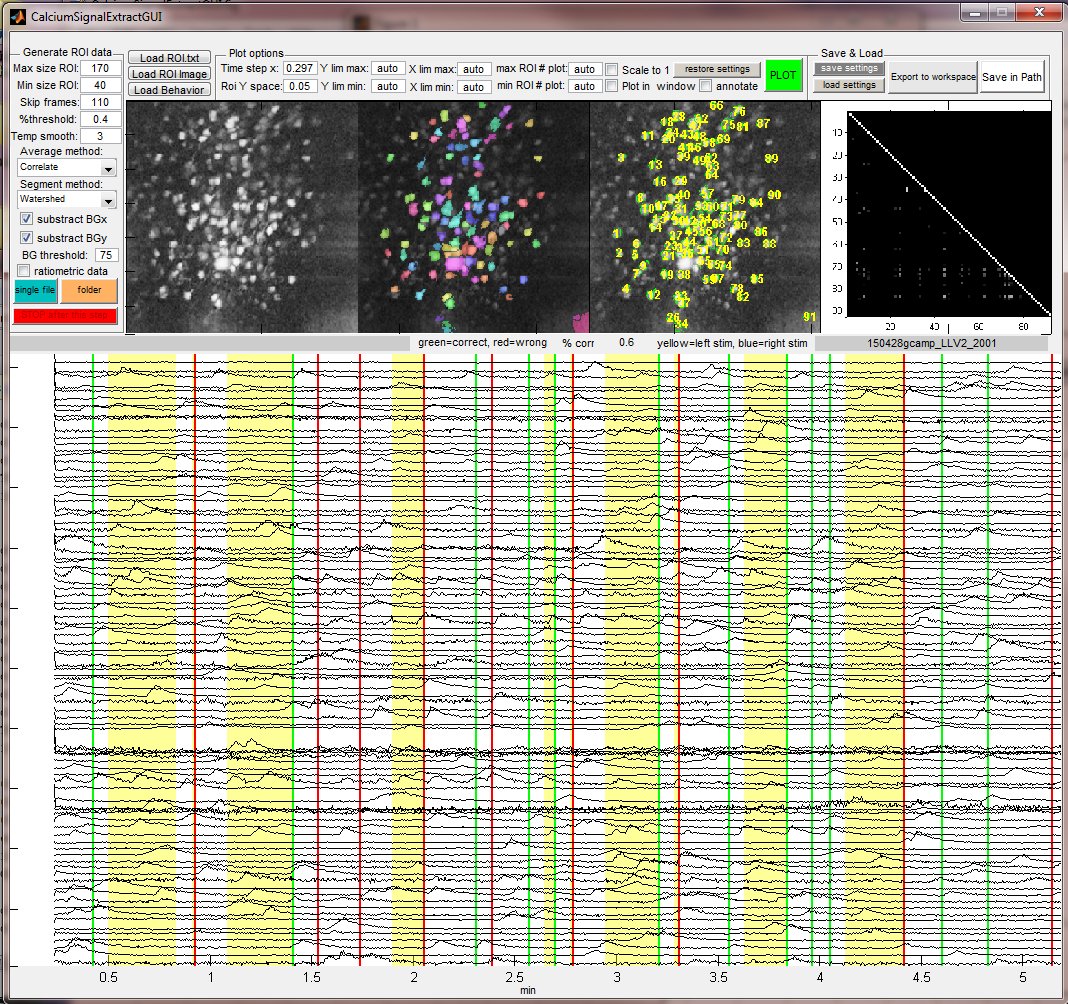 MATLAB Calcium Signal Extract GUI