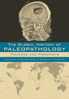 the-global-history-of-paleopathology-596360-1