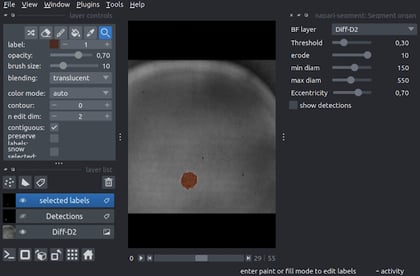 screenshot-of-napari-segment