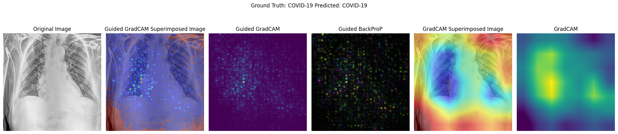 Activation Map Visualisation