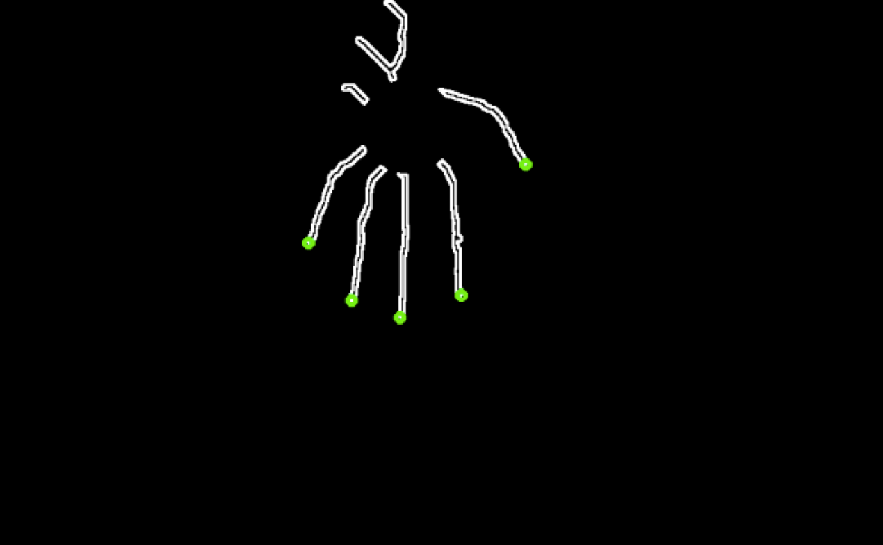 Skeletonized hand