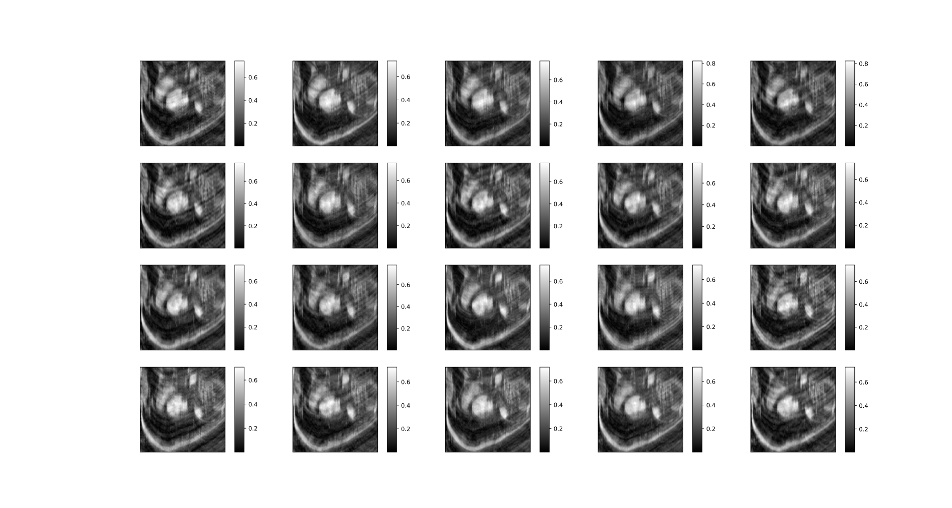 testundersampling7