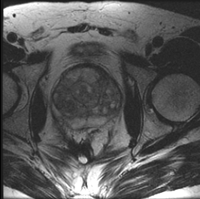 RegLib C07: Prostate MRI pre/post\ 200x199