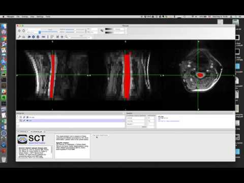 Fsleyes integration