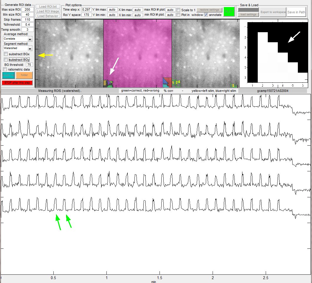 MATLAB Calcium Signal Extract BG