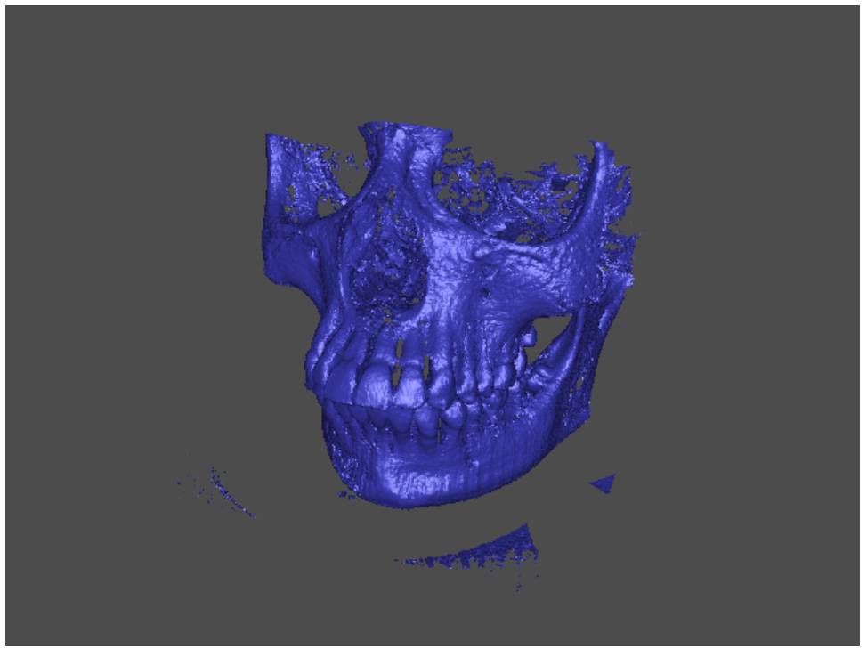 isosurface on the Skull data set