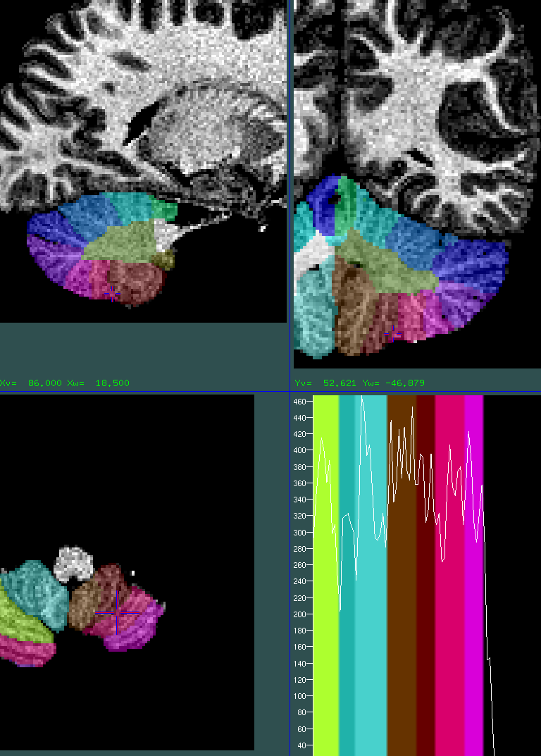 cerebellum 1