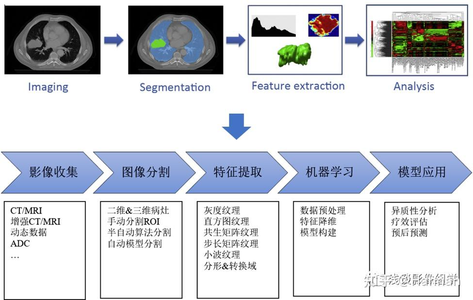 Radiomics-shuoming/0影像组学的介绍与影像组学方法流程.md at main · jasonbme/Radiomics ...