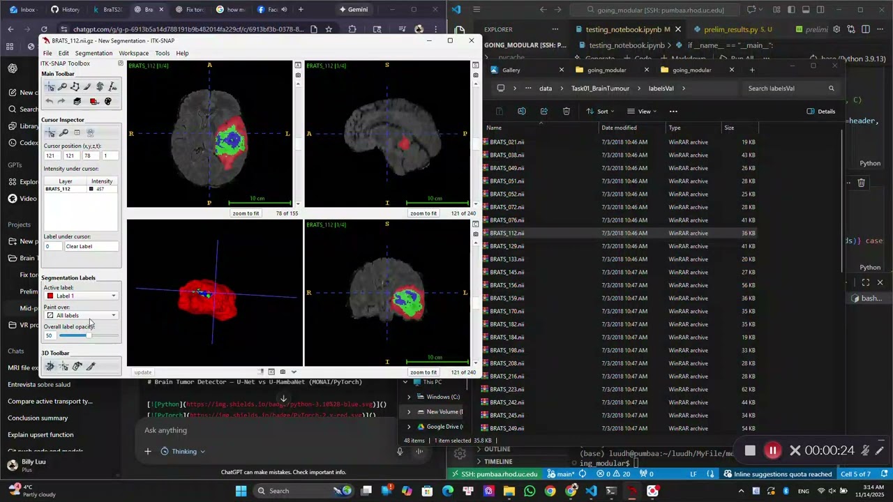 Brain Tumor Detector demo
