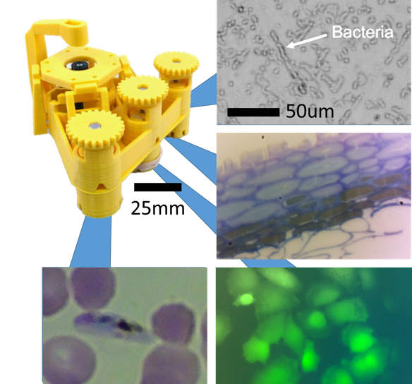 Images taken with the Openflexure Microscope using Raspberry Pi webcam lens.  Clockwise from top right: a frame from a time-lapse series of bacteria growing (courtesy of Waterscope), a section of Pollia fruit (courtesy P. Rudall, Royal Botanic Gardens, Kew, and S. Vignolini, University of Cambridge), fluorescence image of cultured cells (courtesy D. Bressan and S. Reichelt, Cancer Research UK Cambridge Institute), and a malaria parasite, imaged with 100x oil immersion lens at NIMR, Tanzania (courtesy of H. Malebo).
