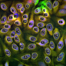 the control image of the mri intensity per nucleus tool