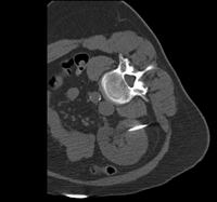 RegLib C17: Abdominal MR-CT\ 200x187