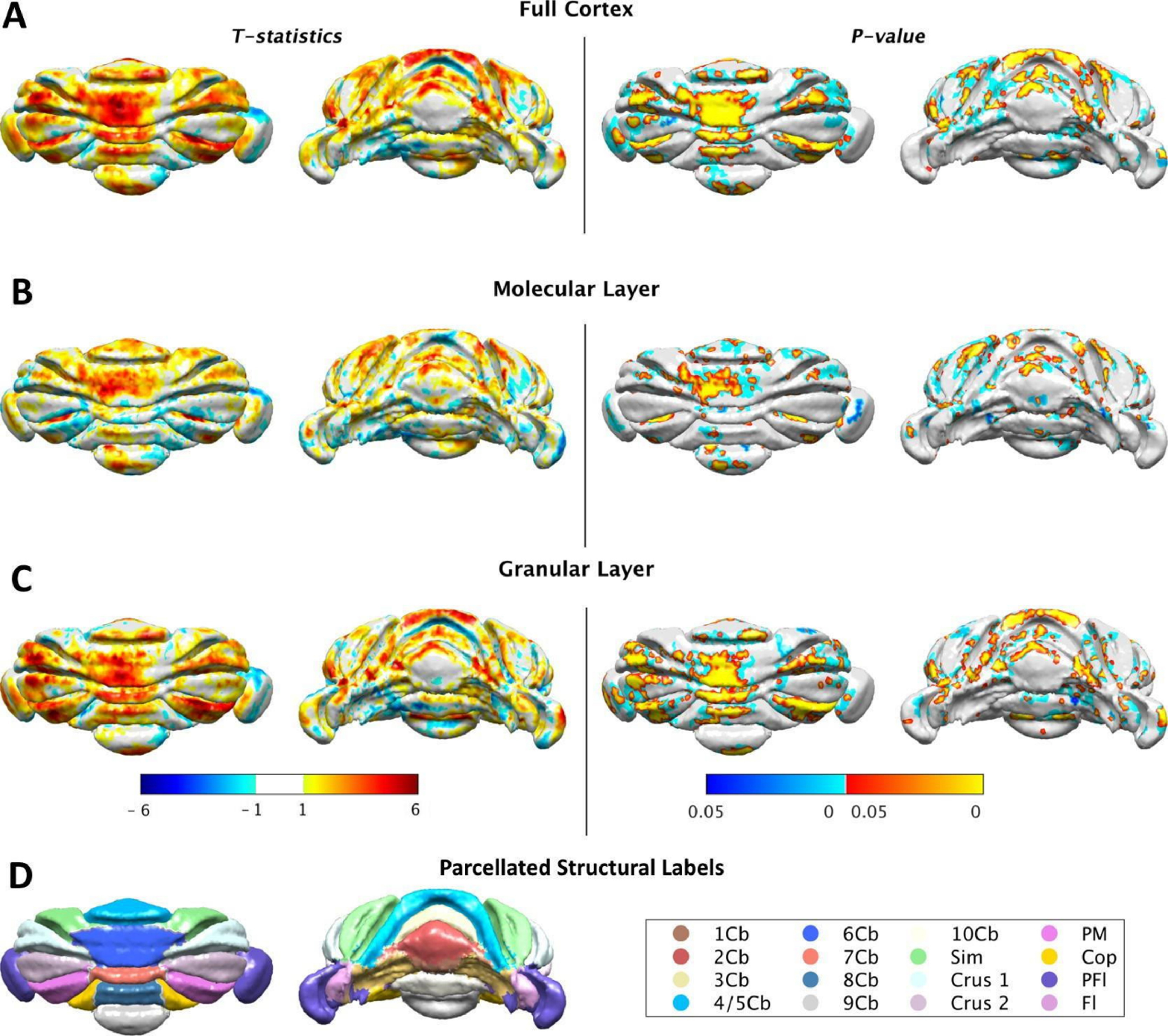 Cortical Morpometry