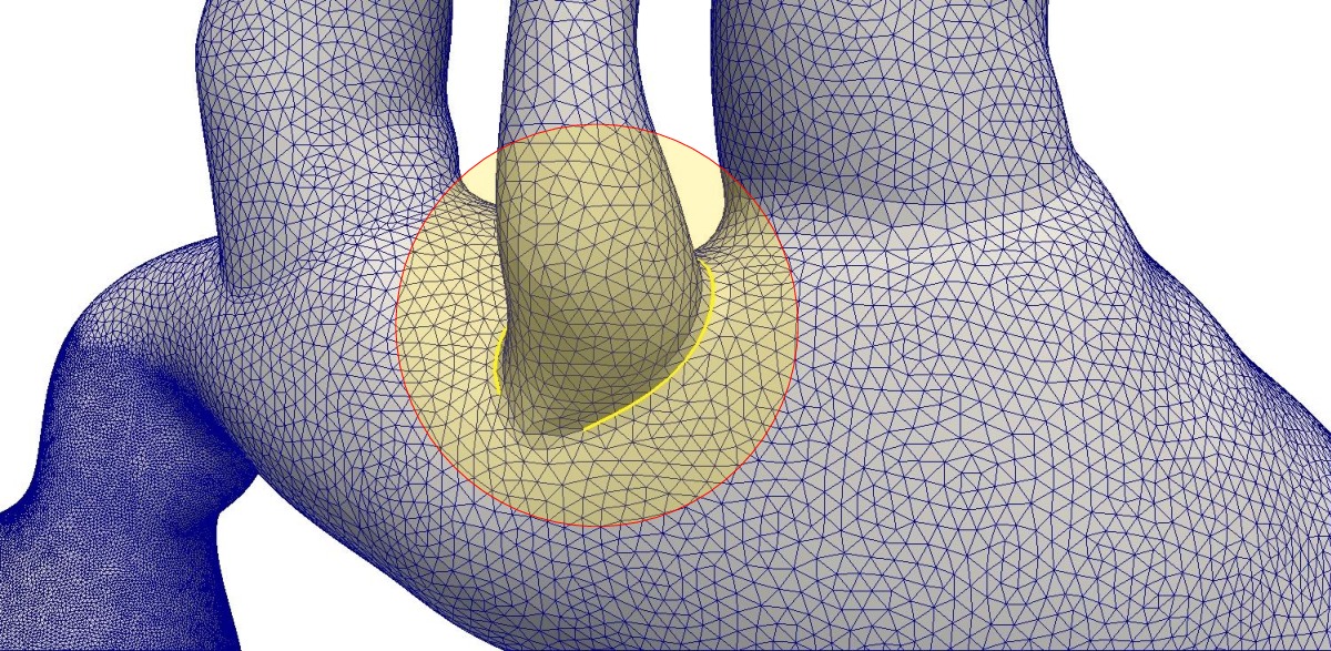 An example of spurious edge that does not construct a featured surface.