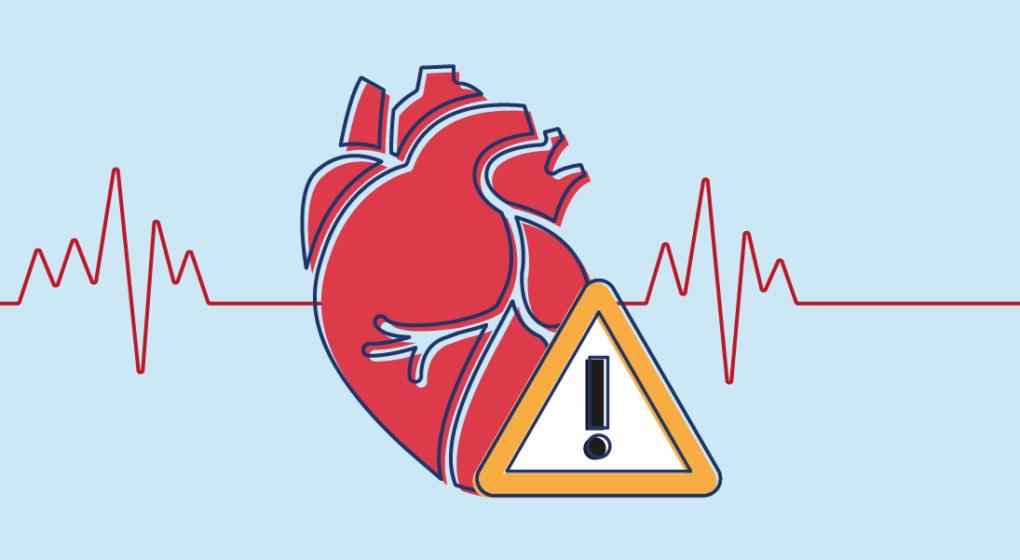 Health Risks - image retrived from MedicineHow on 16/07/2020