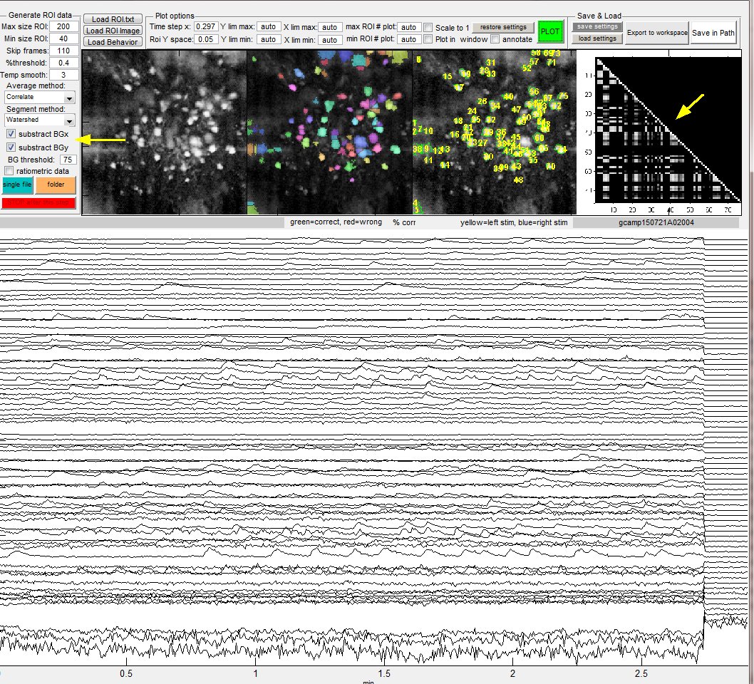 MATLAB Calcium Signal Extract BG removed