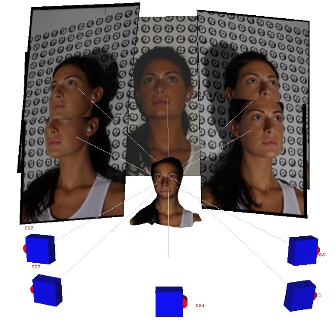 Stereophotogrammetry