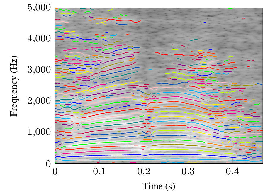 Male voice signal tracking results (/kara/).