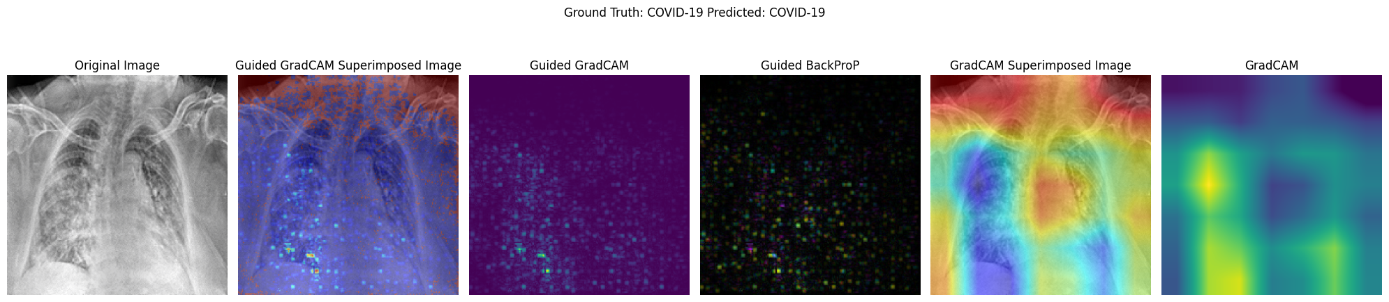 Activation Map Visualisation