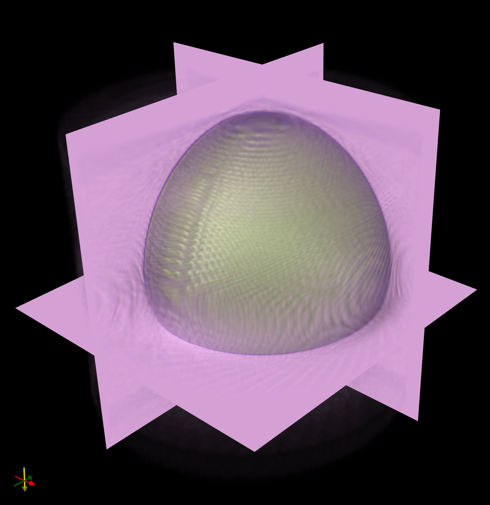 RTK sphere reconstruction