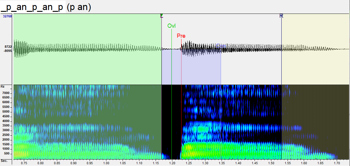 CV Nasal Ditonga