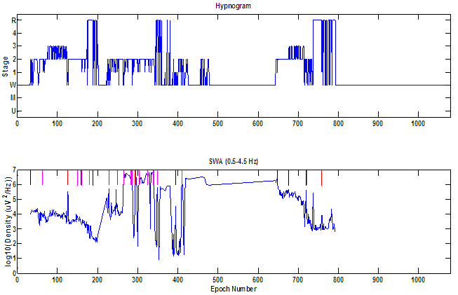 Extreme SW Artifact Example