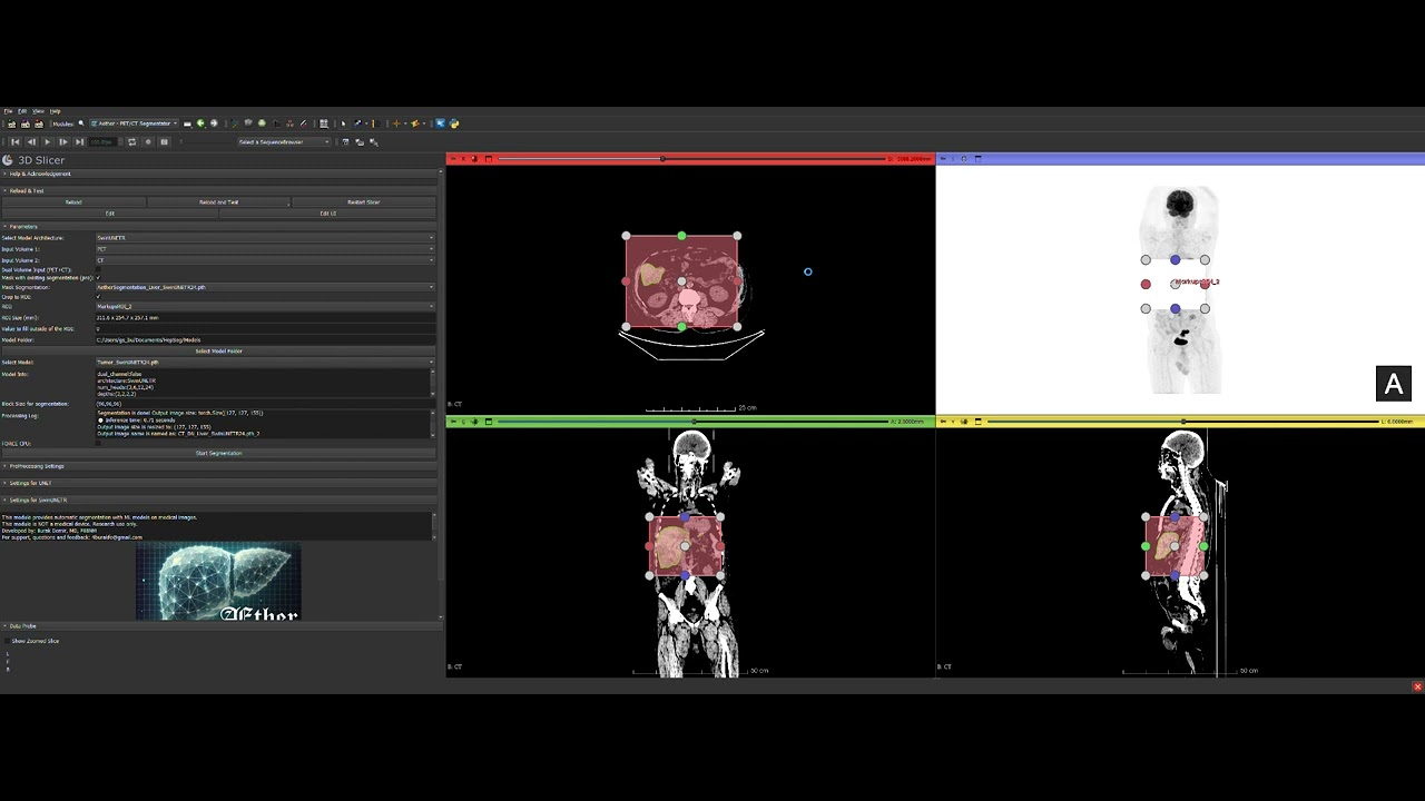 You can watch the module in action from here