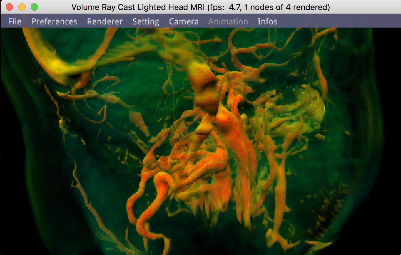 Lighted Volume Ray Casting