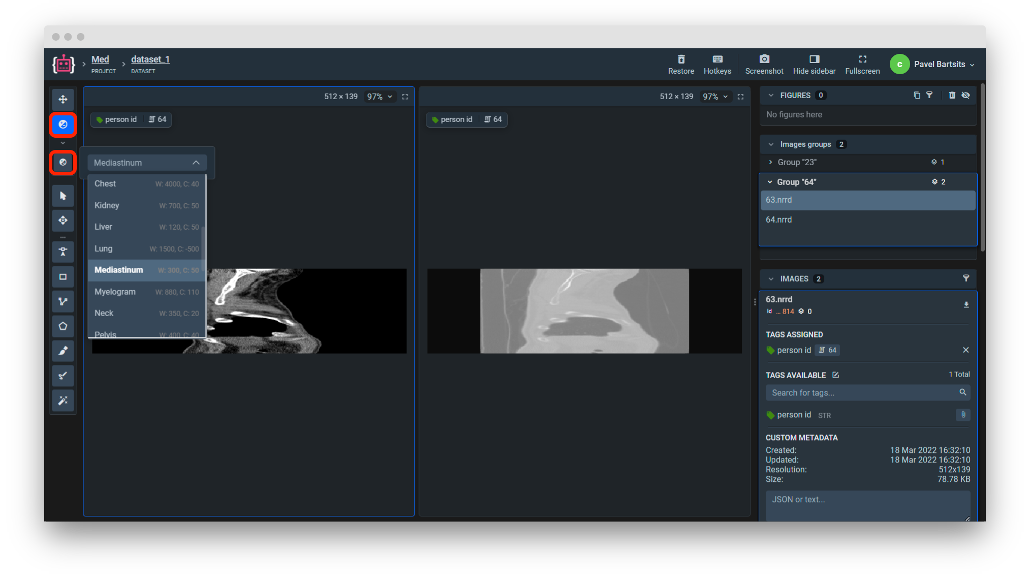 Nrrd windowing tool