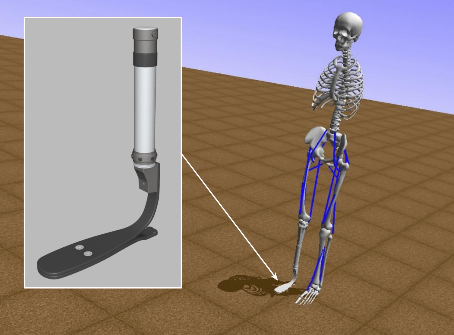 AI for prosthetics