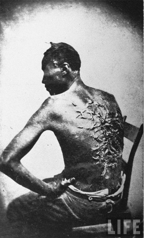 slave wounds