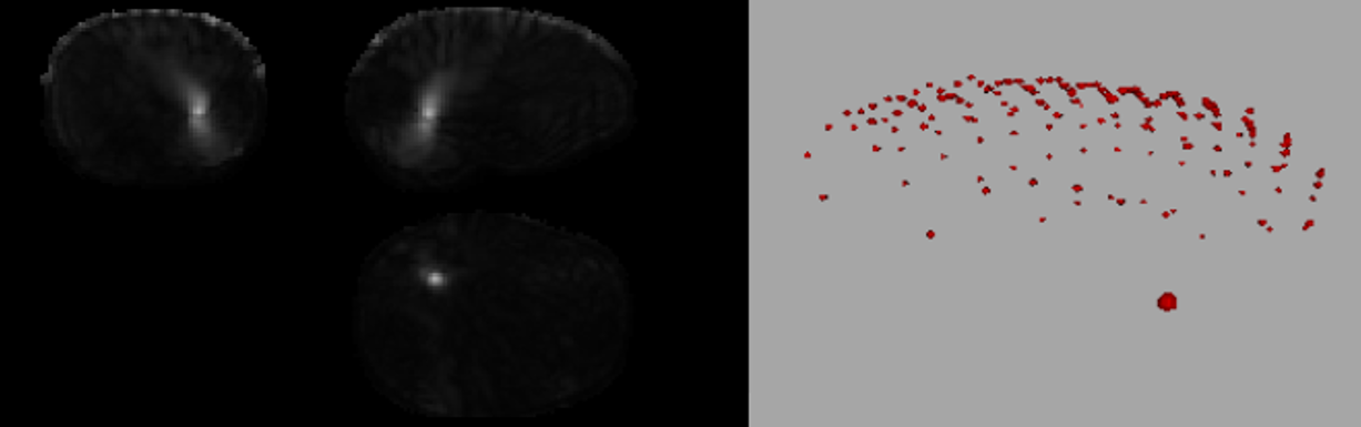 GitHub - ManuelPalermo/BrainUltrasoundSimulation: Simulation of Ultrasound  signals on a 3D Brain model using K-Wave toolbox. Plus simple ultrassound  focusing algorithm.