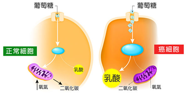 瓦式效应表明，癌细胞代谢糖的方式与正常细胞大不同。（Shutterstock／大纪元制图）