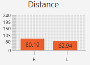 bar chart