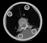RegLib C39: in vitro CT of human vertebra\ 200x184