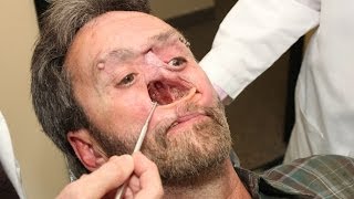 The Man With A Hole In His Face: Body Bizarre Episode 3