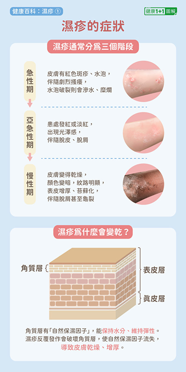 湿疹症状通常都分为三个时期：急性期、亚急性期与慢性期。（健康1+1／大纪元）