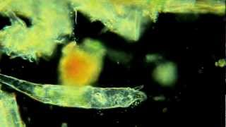 Rotifers Are Awesome!