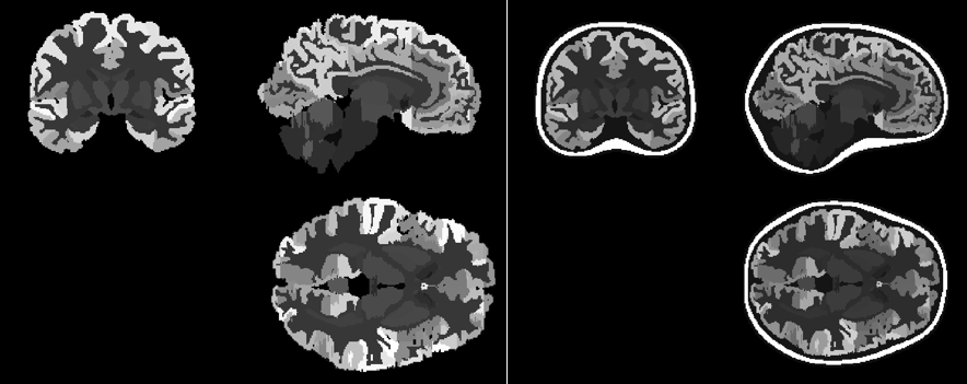 BrainModel