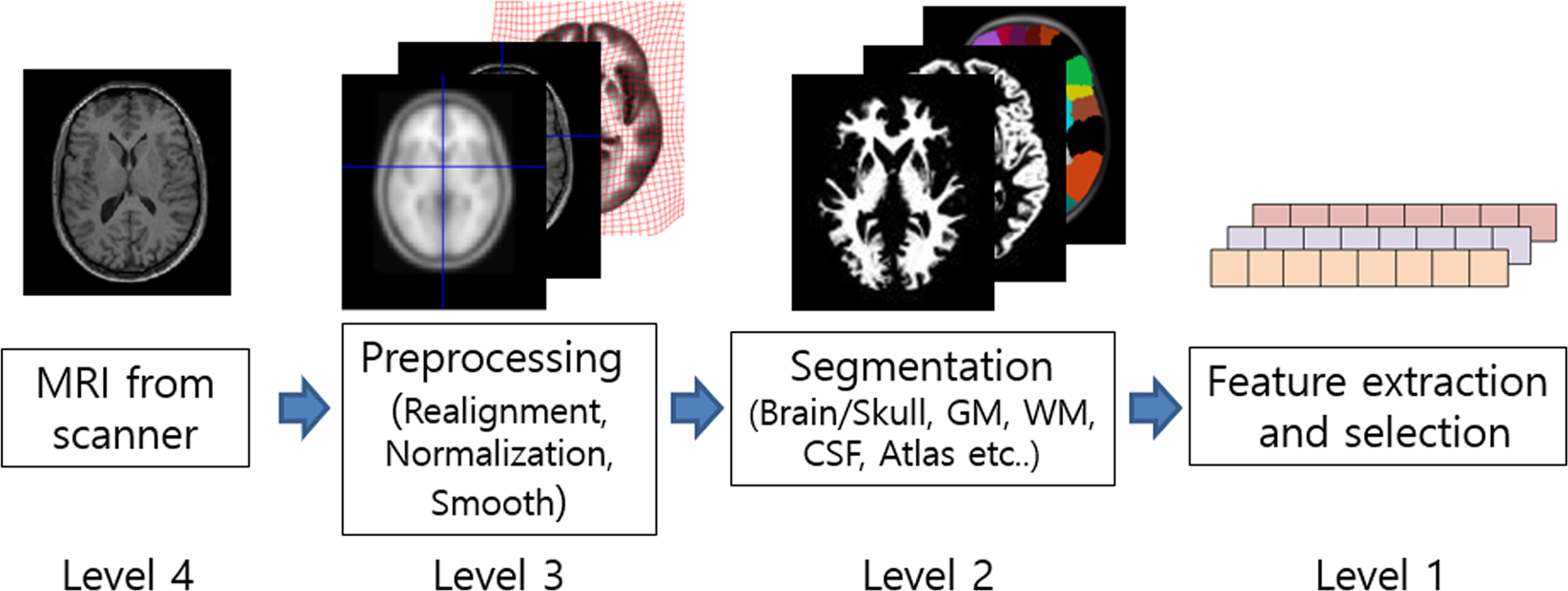 Dementia AI Detection