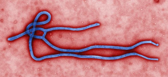 TEM image of Ebola virus virion