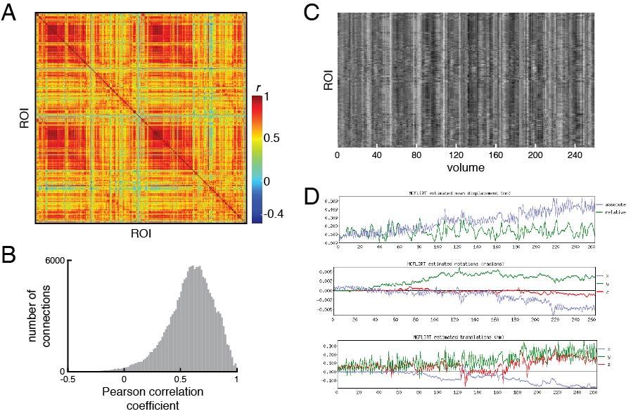 Figure 8. An example of poorly processed resting-state fMRI. (A) Functional connectivity matrix and (B) distribution of functional connectivity show large number of strong positive correlations and a compressed range of correlations. (C) Examination of the carpet plot of region of interest (ROI) time series suggests artefacts remain in fMRI data after cleaning. (D) In the QC Report, motion estimations from MCFLIRT are shown alongside the carpet plots for quick assessment. All images reproduced from the example subject’s QC Report.