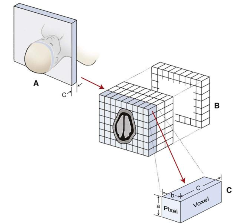 (A) CT image (B) Image array (C) Voxel with sizes axbxc