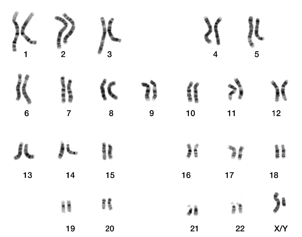 A karyotype of a human male