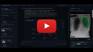 MedHyperGraph demo video