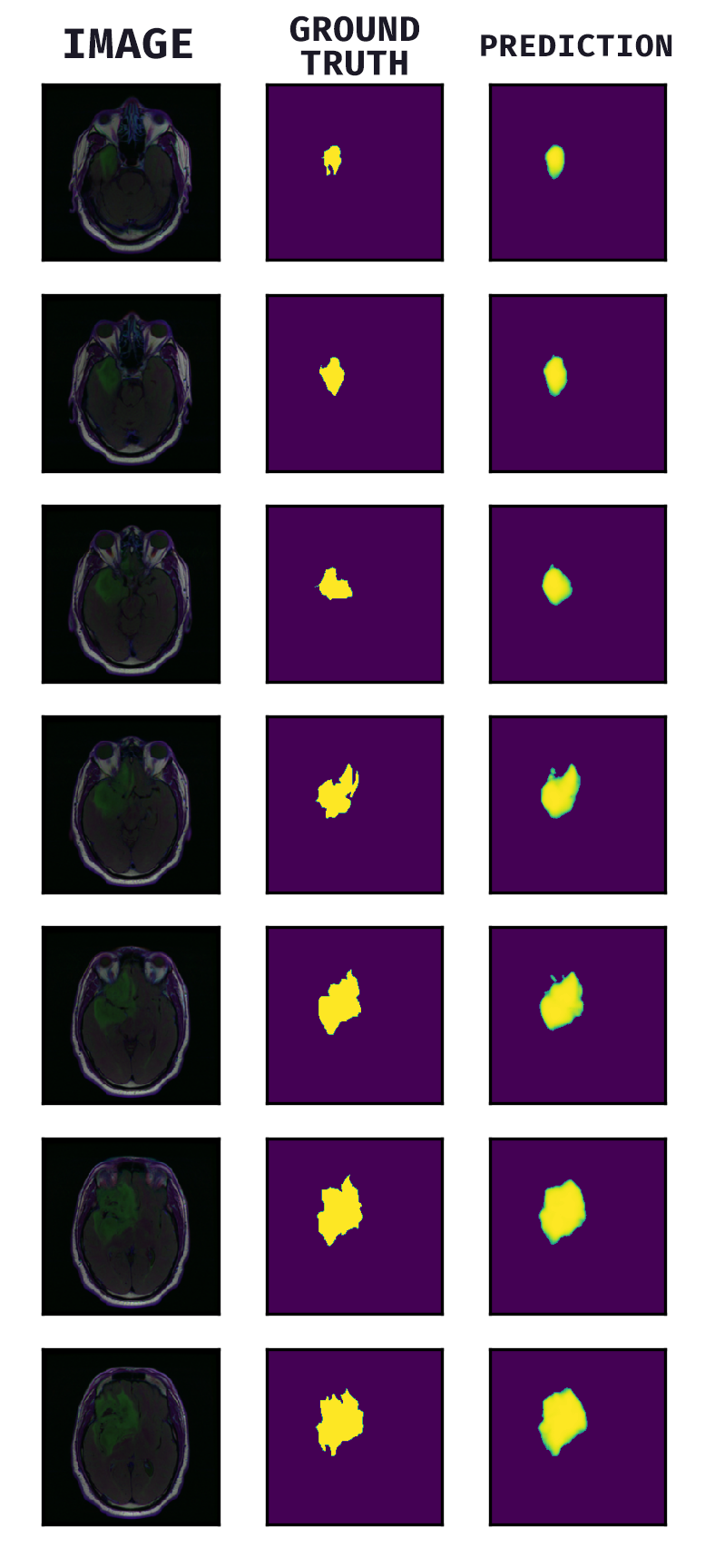 Example one patient data