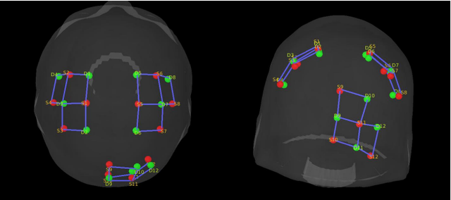 Fig. 1 Montage