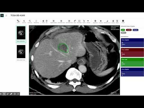 Segmentation Tool