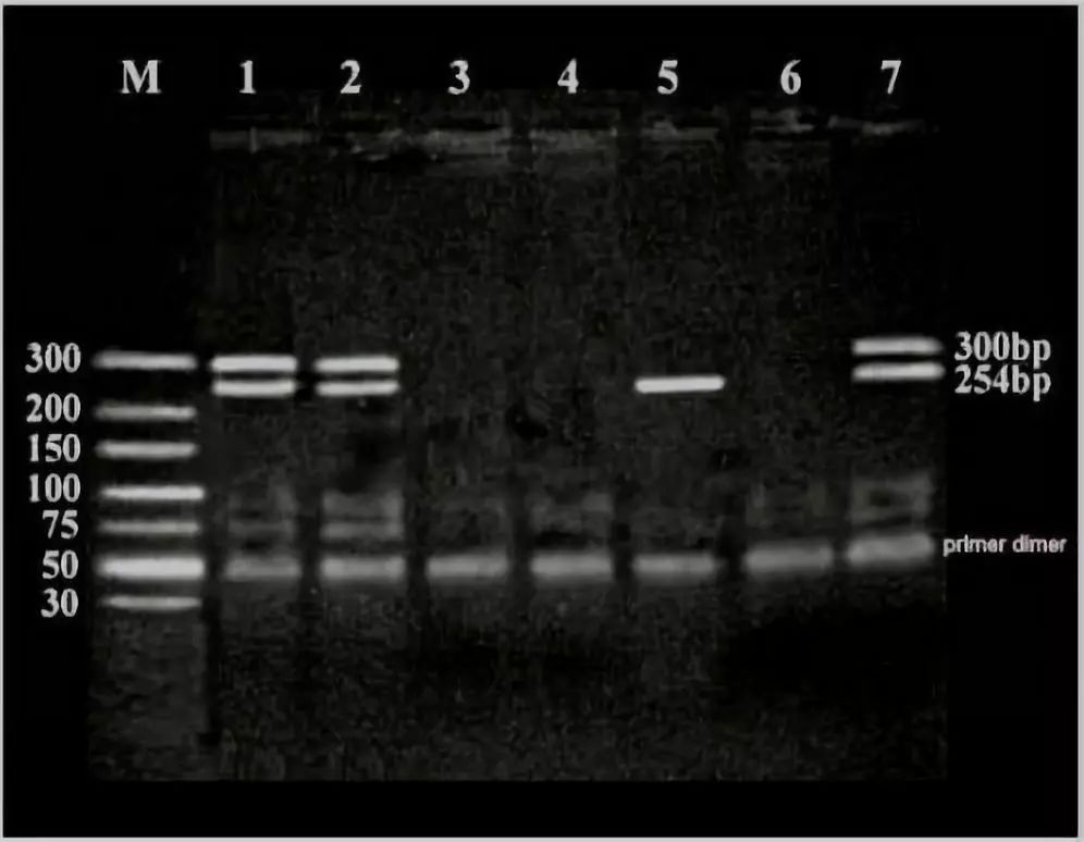 电泳PCR产物显示SRY基因的条带大小为254bp